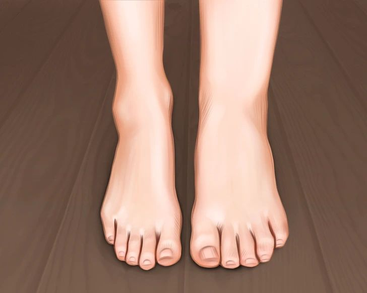 Проблема утренних отеков после 50: что исключить из рациона