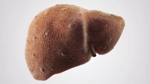 ������ ������: ��� ����������� ���������� ����� � ����