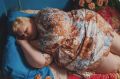 Стресс и лишний вес: неожиданные связи, о которых стоит знать